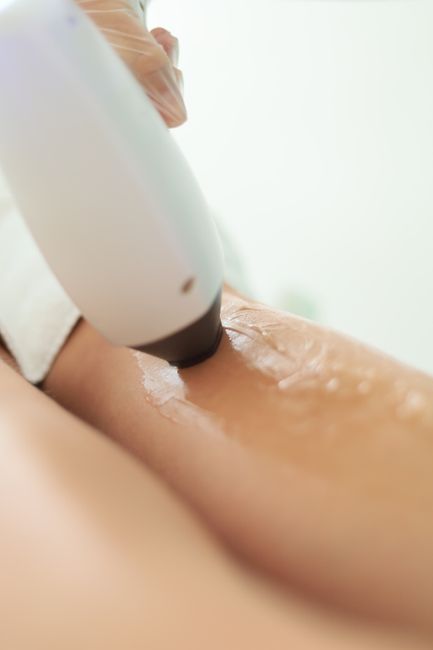 Fatih'te Pürüzsüz Bir Cilt İçin Lazer Epilasyon: Alena Beauty Farkıyla Kalıcı Güzellik