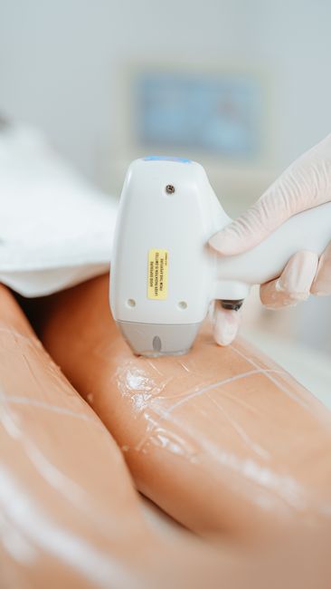 Fatih'in Kalbinde Pürüzsüz Cilt Hayali: Alena Beauty ile Lazer Epilasyon Deneyimi